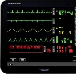 Spacelabs patient monitors offer fast access to comprehensive patient information where and when needed. In this way, our monitors help speed and support your decisions, which in turn can improve response time, advance patient care, and enhance patient safety.